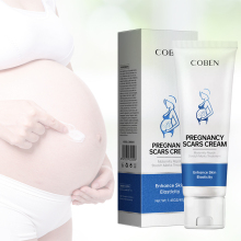 Private Label Natural Organic Repair Stretch Mark Cream for Legs