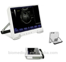 Hospital Ultrasound Equipment & Ultrasound Scanner & ultrasound machine portable