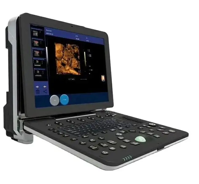 4D Color Ultrasound Doppler Probe Machine