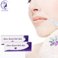 Siringa HA Face Dermal Filler da 2 ml