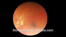 Wifi/USB interface Eye diagnosis machine eye camera for clinic inspection