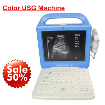 Laptop Ultrasound Scanner
