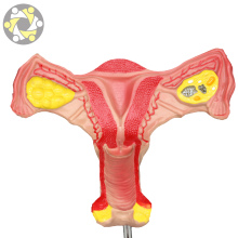 Female Reproductive Anatomy Model: Uterus and Internal Genital Organs