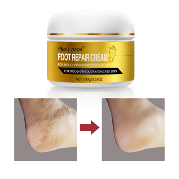 OEM Wholesale Organic Shea Butter Foot Mask for Cracked Heels