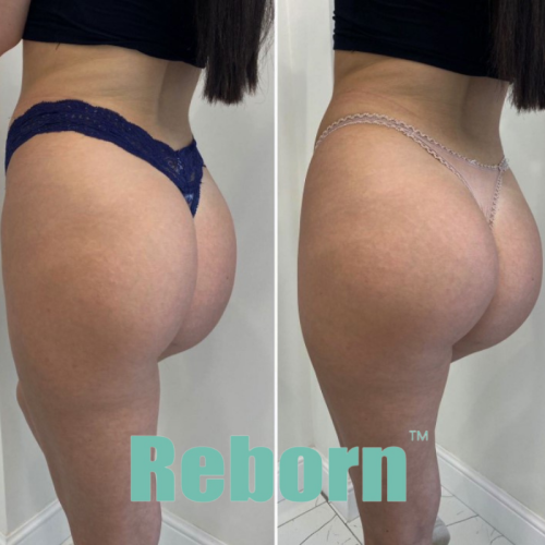 Beauty Body Medical Aesthetic Treatment For Cosmetic Surgery
