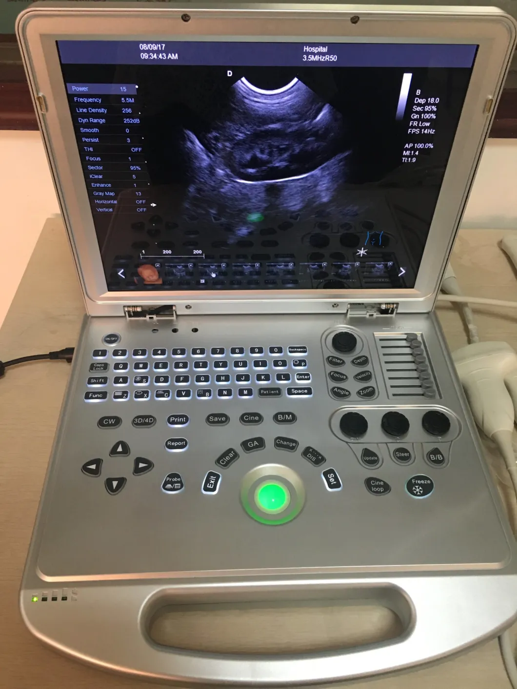 Portable 4D Color Doppler Ultrasound Scanner