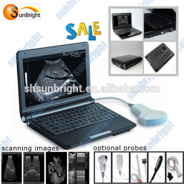 laptop mini ultrasound device