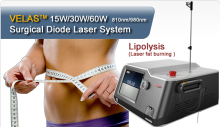 Laser Liposuction