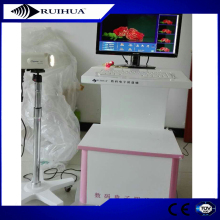 Digital Video Electronic Colposcope Colposcopy Instrument for Vagina