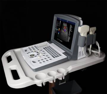 Portable Color Doppler Ultrasound Scanner for Vascular