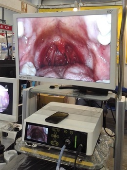 Arthroscopy camera endoscope system