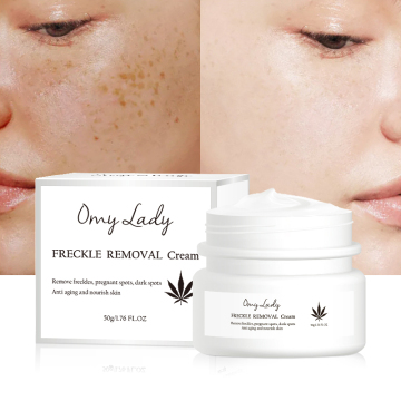 Omylady Organic Face Moisturizer - Freckle Fade Removal Cream