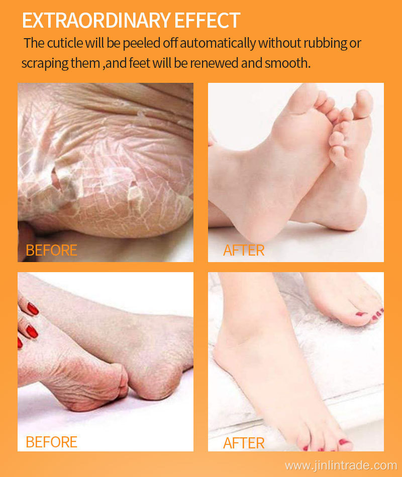 Dead Skin Remover Lavender Exfoliating Peeling Foot Mask