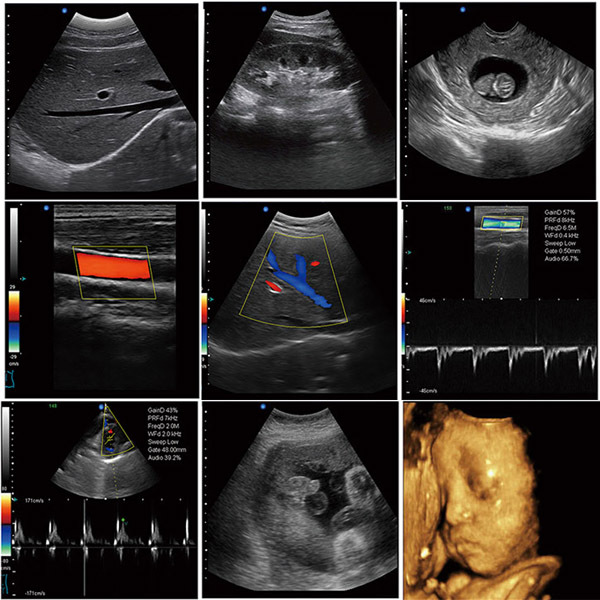 5 Ultrasound scanner