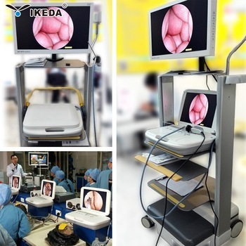 HD ENT endoscopy camera for endoscope