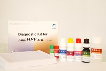 hepatitis E IgM ELISA diagnostic KIT