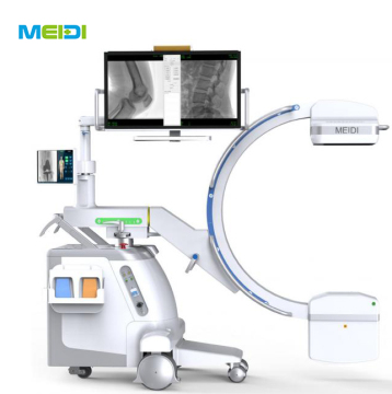 Mobile Integrated Flat Panel C-Arm Machine