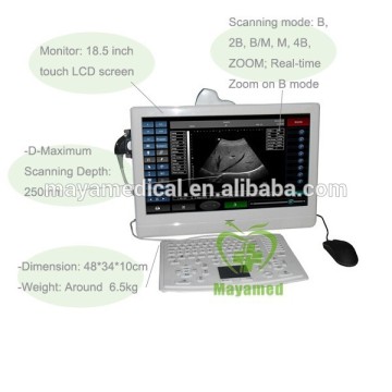 MY-A006 Compatible with laser/inkjet printers Touch screen LCD ultrasound scanner