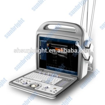 Doppler Ultrasound Equipment Type portable color doppler ultrasound