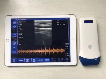 handheld ultrasound devices wireless