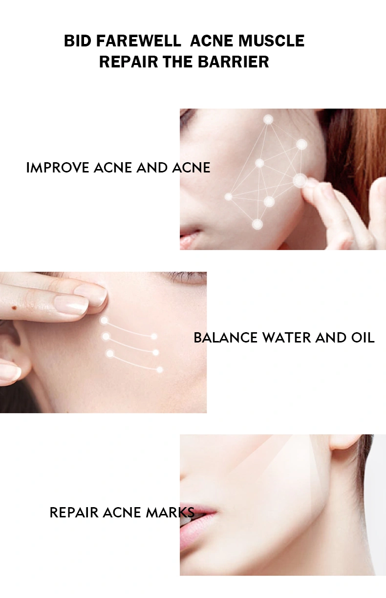 OEM Acne Removal Toner Moisturizing Tea Tree Whitening Facial Toner Organic Face Toner Spray