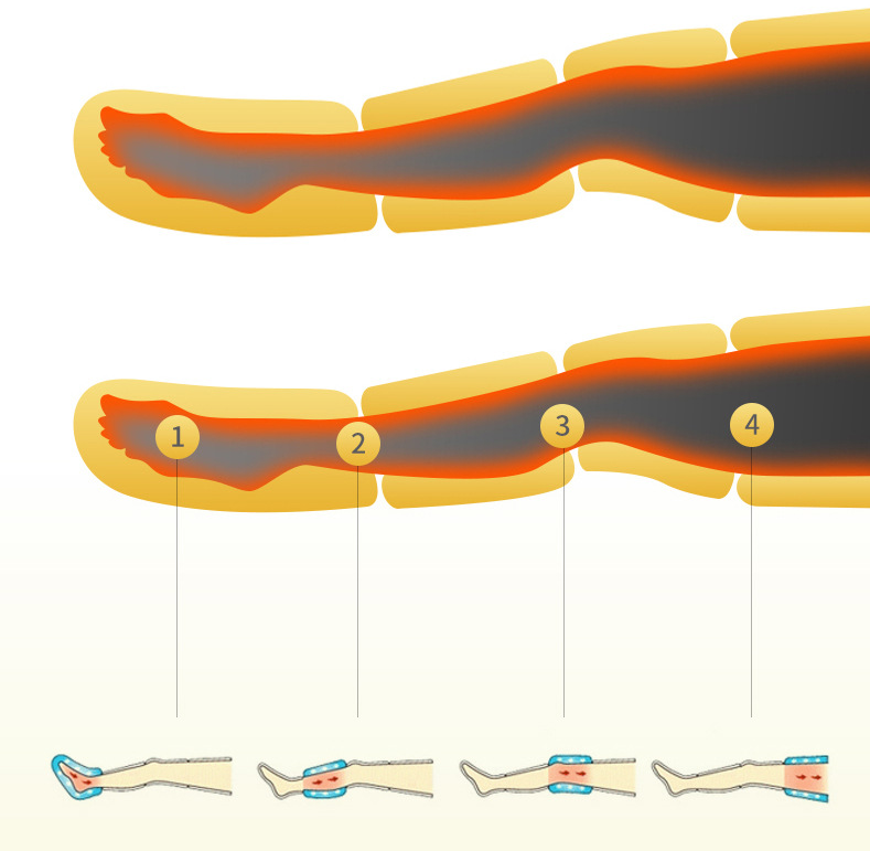 Sequential Compression Therapy System