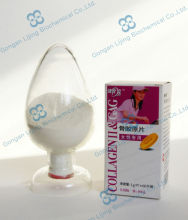 Undenatured Collagen Type II