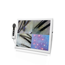 Hair and Skin Analyzer Camera