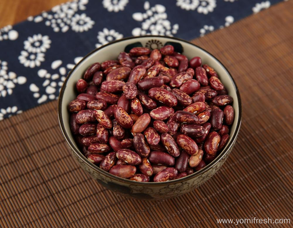 Kidney Beans Good For Kidneys