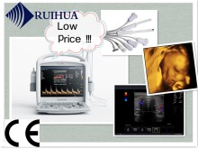 Portable Ultrasonic Diagnostic Devices Ultrasound Machine Price