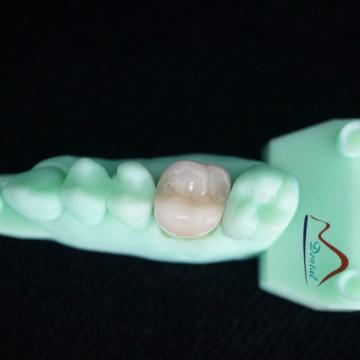 3D Printing Model PFM Cocr Crown