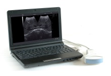 Laptop Ultrasonic Diagnose Scanner