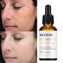 Vitamin C Serum: Anti-Aging, Whitening, Moisturizing Face Serum for Skin-Friendly Black Spot Correction and Repair