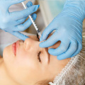 Dermal Fillers For Wrinkle Reduction