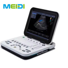 Full Digital Color Doppler Ultrasonic Diagnostic Instruments