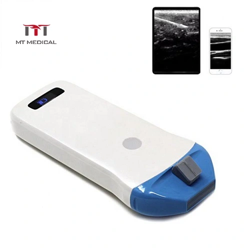 Mt Medical Newest Portable 128 Elements Wireless Ultrasound Probe