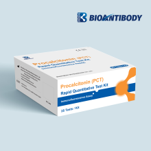 Procalcitonin (PCT) Rapid Quantitative Test Kit (Immunofluorescence Assay)