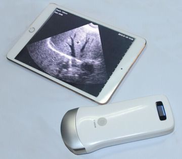 UProbe-2 Array Ultrasound Probe Scanner