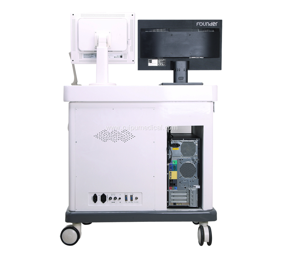 Medical 3D Trolley Ultrasound Machine with Workstation