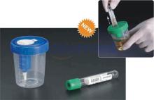 Urine Collection System