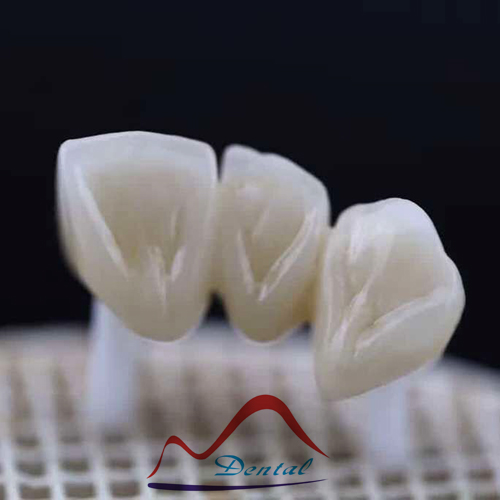 Ziconia layerd crowns i