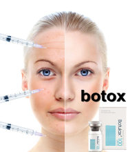 Cosmetic Dermatox Botolisem Toxin Type a for Wrinkle Injection