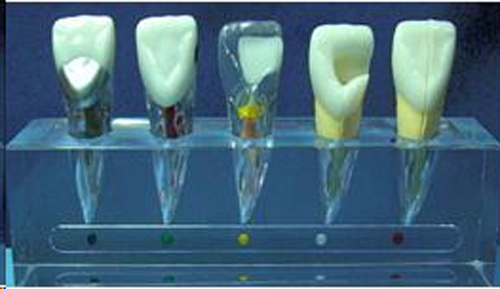 Clinical Model of Endodontics