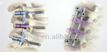 orthopedic spine surgery system products