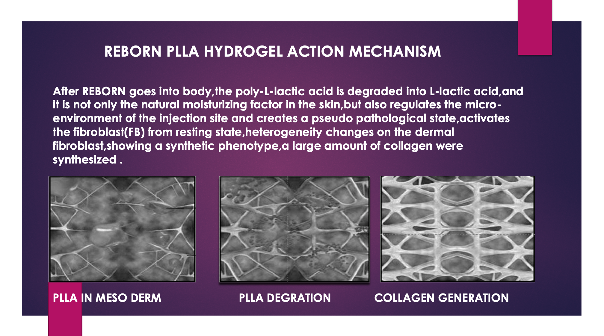 2 ml 5 ml Reborn PLLA Hydrogel för att ta bort melaninet i kroppen