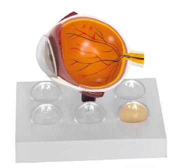 Cataract model