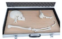 Human Bone Lever Classification Model