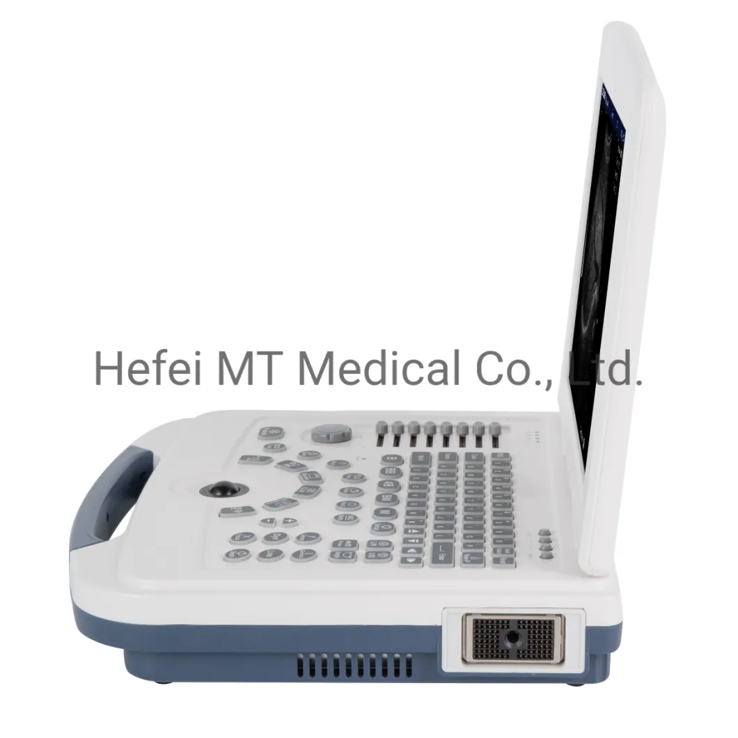 Mt Medical Hospital Portable Color Doppler Ultrasound