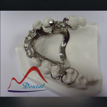 Ti Framework Partial Denture