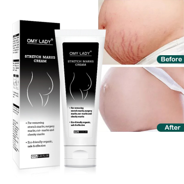 OMY LADY Mango Pregnancy Stretch Marks Repair Cream